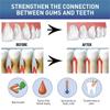 Gel Cura Riparazione Gengive Allevia Gengive Doloranti Migliora Infiammazione Gengivale Danneggiata Pulizia Macchie sui Denti Tartaro Sbiancante Gel Protettivo Gengive