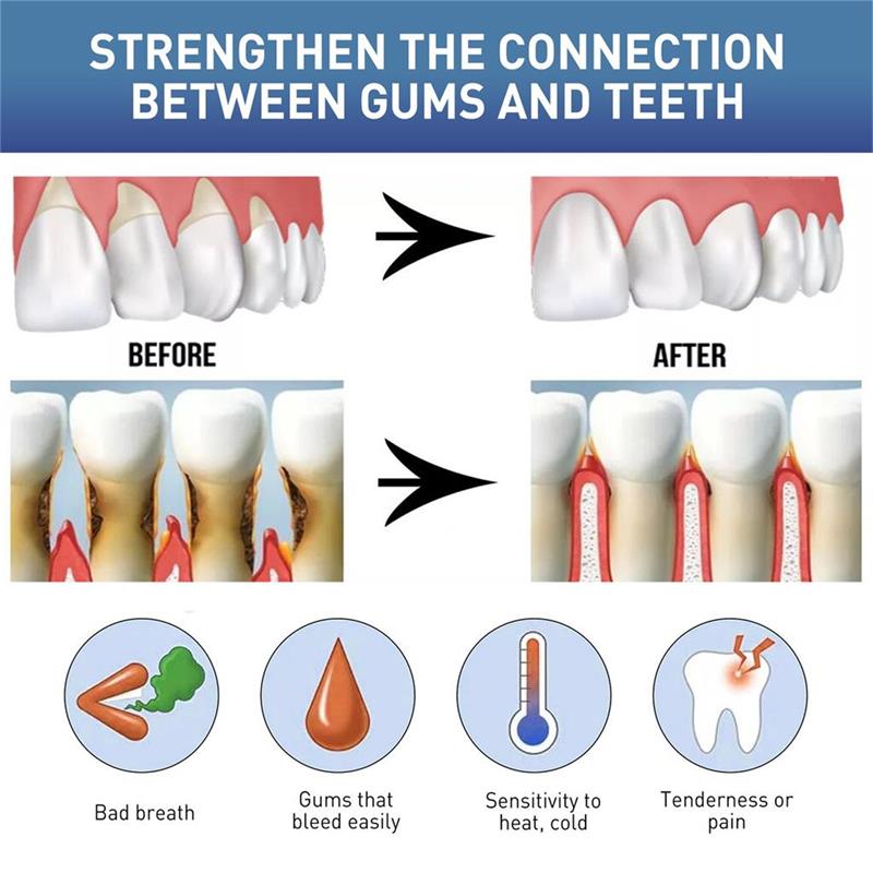 Gel Cura Riparazione Gengive Allevia Gengive Doloranti Migliora Infiammazione Gengivale Danneggiata Pulizia Macchie sui Denti Tartaro Sbiancante Gel Protettivo Gengive