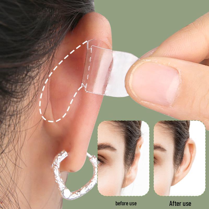 Elf Ear Stickers: Invisible Support for Ear Shaping and Photography