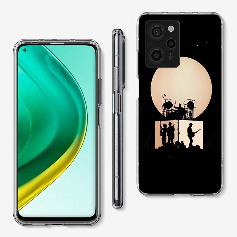 

M-Morat Band Cover Phone Case For Xiaomi Poco M8 M7 M6 M4 M3 X7 X6 X4 Pro F7 Ultra M5S Mi 14 14T 15 15T 12T 10T Pro 12S 12 11 Li Xiaomi Mi 12(12S)