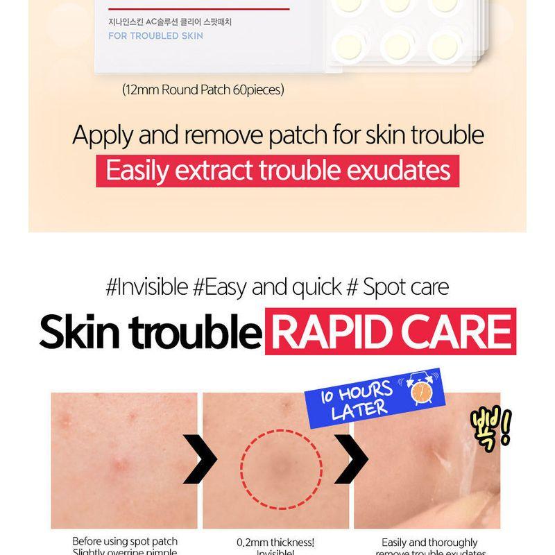 G9SKIN - Zero Solution Spot Cover Patch 108pcs