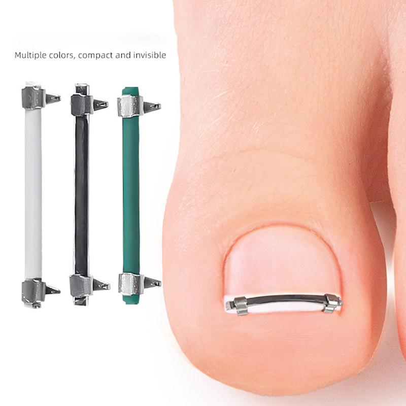 Narzędzie do Pedicure na Wrastające Paznokcie u Stóp Wkładka Pielęgnacja Paznokci u Stóp Prostowanie Korekcyjne Klips Zakrzywiony Zacisk Narzędzie do Korekcji Paznokci u Stóp