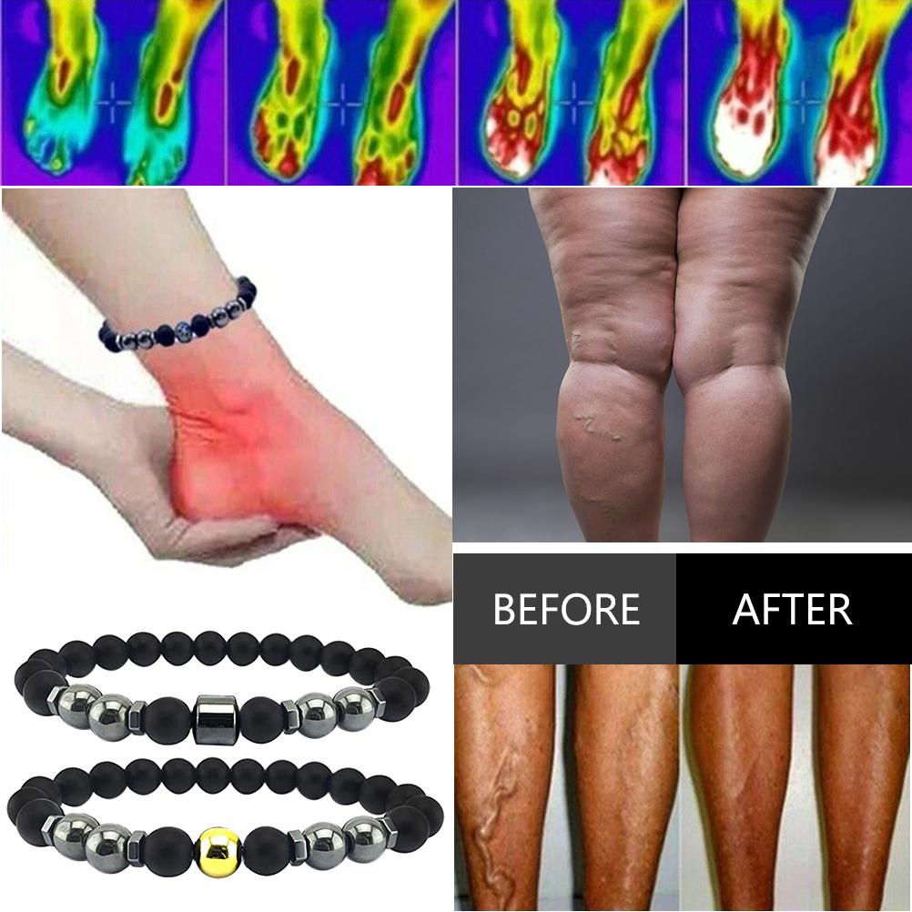 5Pcs Anti Swelling Black Obsidian Anklet Magnetic Therapy Bracelet Adjustable Weight Loss Magnet Anklet for Men Women