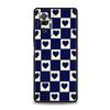Checkerboard checked chess board Phone Case For Xiaomi Redmi Note 14 13 12 5G 11 10 Pro Plus 4G 9S 9 14C 13C 12C 10C 9C 9A Cover