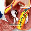 Authentic Human Heart Anatomy Model with Detachable Parts, B-Ultrasound & Color Ultrasound Compatible, 5:1 Scale