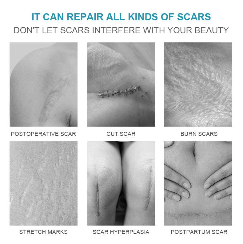 1pc Deep Whitening and Removing Freckles Melasma and Dark Spots Melanin Gel Whitening Facial Skin Care Aging Body Care