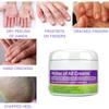 Skin Antipruritic Care Cream Body Moisturizing Repair Nourishing Cream