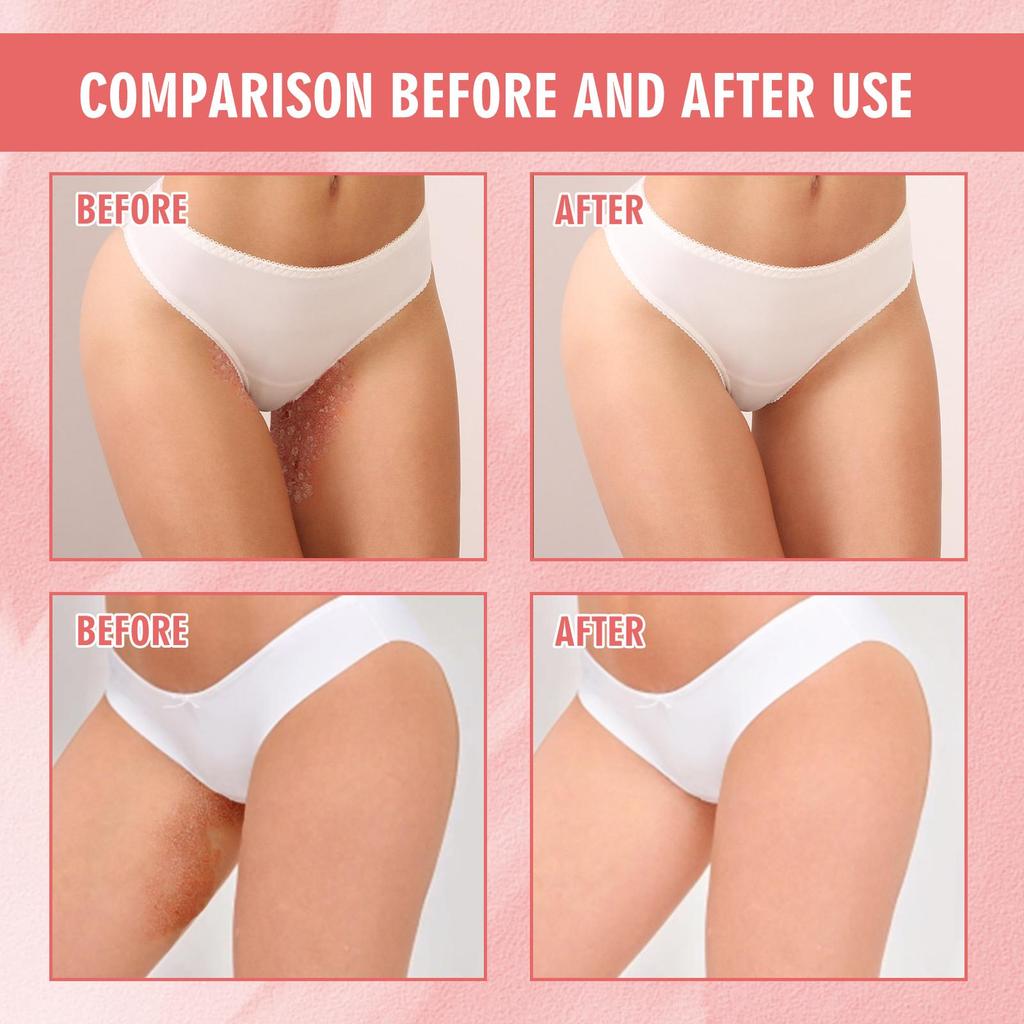 SouthMoon Inner Leg Balm Women's Private Parts Odor Removing, Moisturizing, Skin Repairing Balm