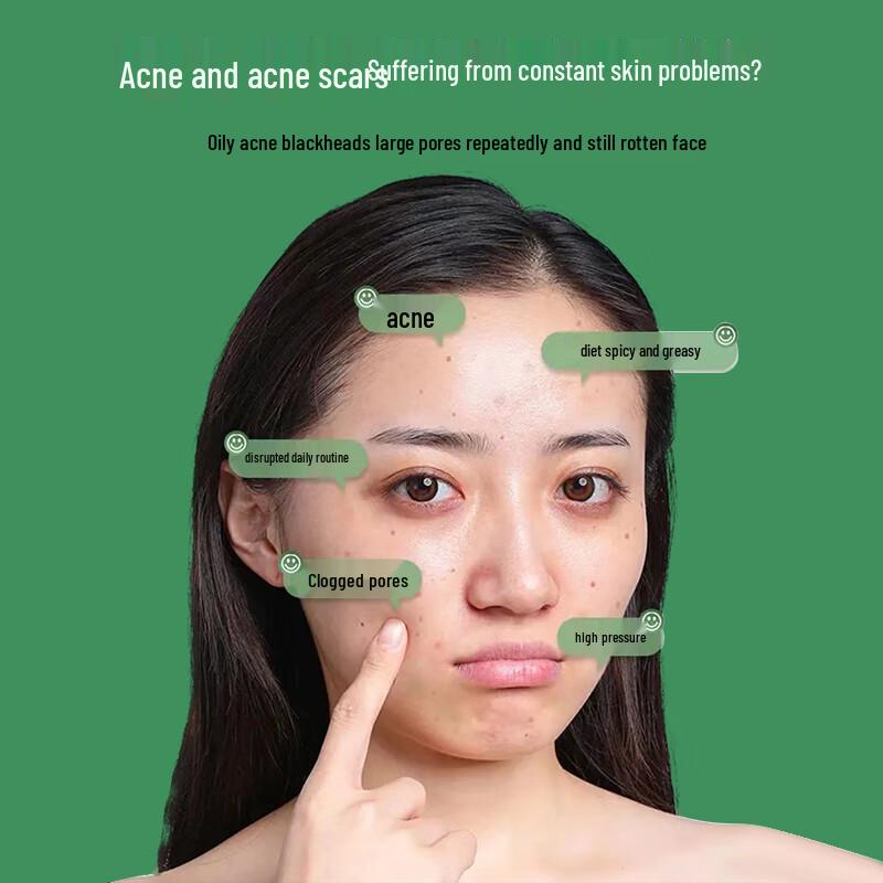 Гель для лечения акне ZhiQu Herbal