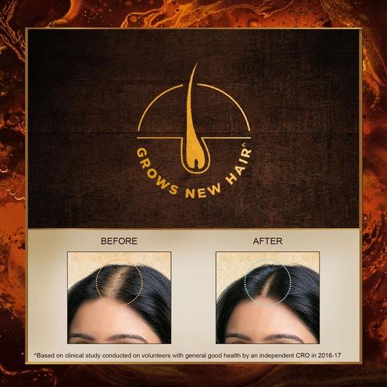 Indulekha Bringha Ayurvedic Hair Oil 100 Ml|| Hair Fall Control and Hair Growth with Bringharaj & Coconut Oil - Comb Applicator Bottle for Men & Women