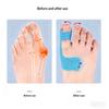 20Pcs Bunion Corrector & Pain Relief Kinesiology Athletic Tape For Bunions & Turf Toe,Big Toe Spacer/Separator/Straightener Tape