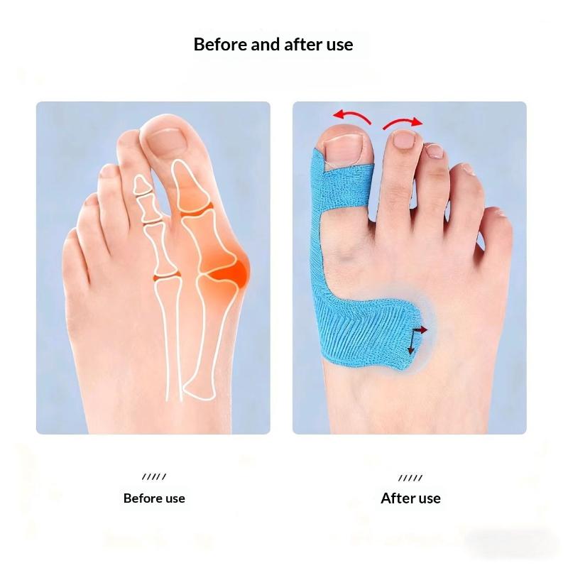 20Pcs Bunion Corrector & Pain Relief Kinesiology Athletic Tape For Bunions & Turf Toe,Big Toe Spacer/Separator/Straightener Tape