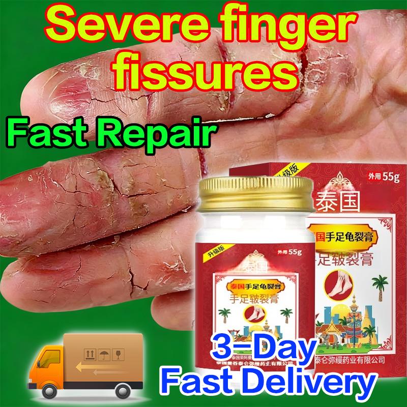 Intensive Repair Hand Therapy