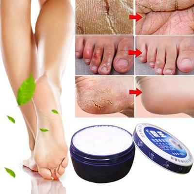 88g Anti Crack Ενυδατική Κρέμα Χεριών Ποδιών Repairing Fissures Heal