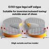 1 Pair Leg Correction Insoles For Adults O Type Legs Fix Bow Legs Improve Valgus And Toe Out Gray Shoe Pad