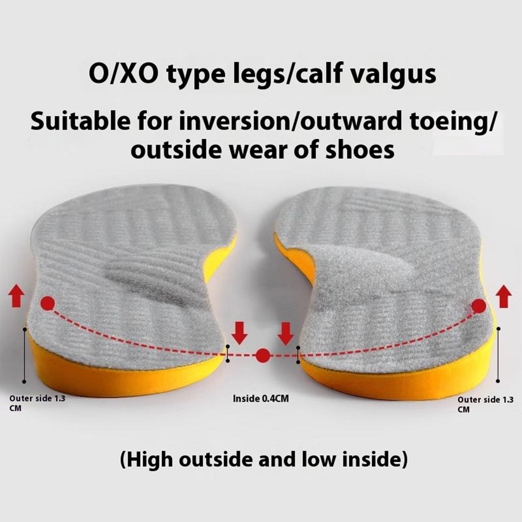 1 Pair Leg Correction Insoles For Adults O Type Legs Fix Bow Legs Improve Valgus And Toe Out Gray Shoe Pad