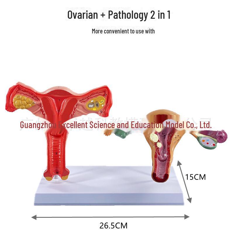 

Расширенная модель женской репродуктивной системы: Моделирование патологической гинекологической анатомии матки и яичников