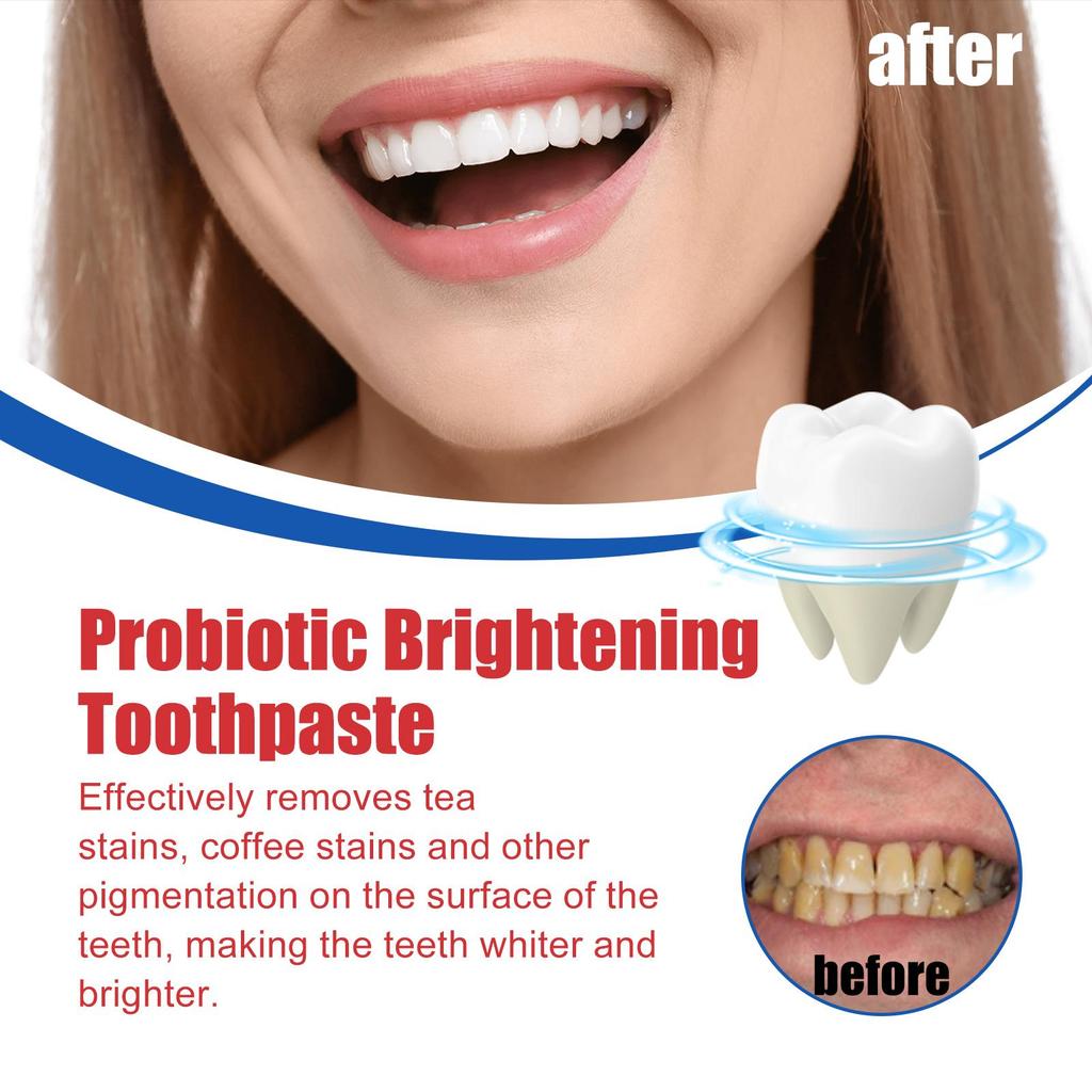120g Sp 6 Ultra Whitening Teeth Toothpaste Probiotic Fresh Breath Brightening Stain Remove Dental Clean Care Toothpaste Promoting Oral Health