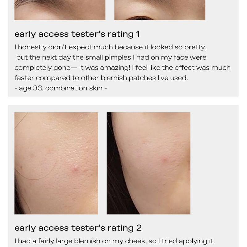 glow Diamond Drop Blemish Patch