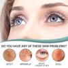 EELHOE Whitening Freckle Cream Nicotinamide Dark Spot Remover Moisturizing Skin Care Brightening Anti-Aging Face Beauty Care 50g
