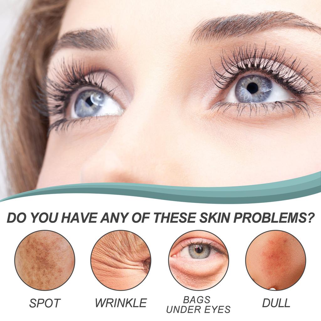 EELHOE Whitening Freckle Cream Nicotinamide Dark Spot Remover Moisturizing Skin Care Brightening Anti-Aging Face Beauty Care 50g
