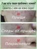 Cream for facial inflammation, acne and blackheads, for oily and problem skin, suitable for teenagers and adults, 15 g