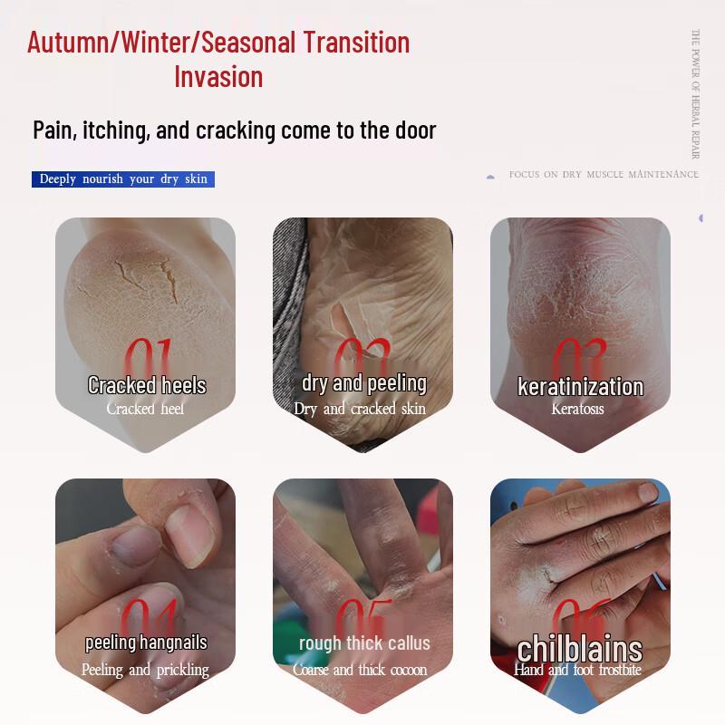 Taichuan Horse Oil Anti-Cracking Hand & Foot Balm Stick