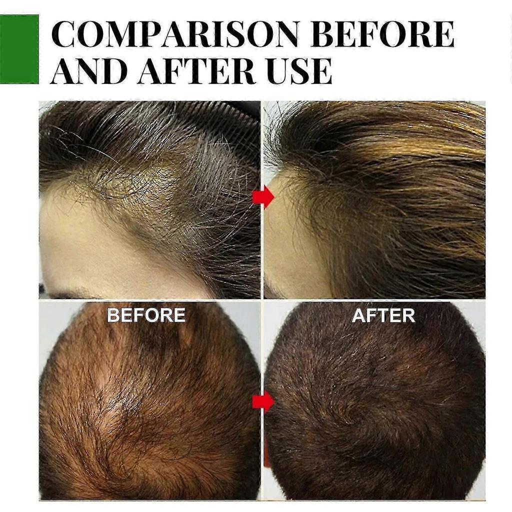 2pcs 30ml Rosemary Hair Oil Nourishment Scalp Stimulates Hair Growth Hair Care Oil