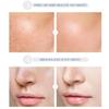 Moisturizing Rejuvenating Facial Serum with Hyaluronic Acid 17ml Eight-color Essence Liquid Sodium Hyaluronate Cherry Niacinamide