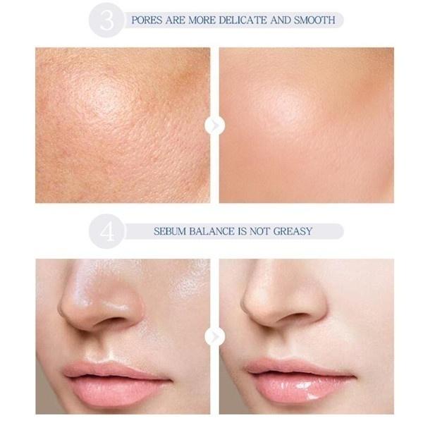 Moisturizing Rejuvenating Facial Serum with Hyaluronic Acid 17ml Eight-color Essence Liquid Sodium Hyaluronate Cherry Niacinamide