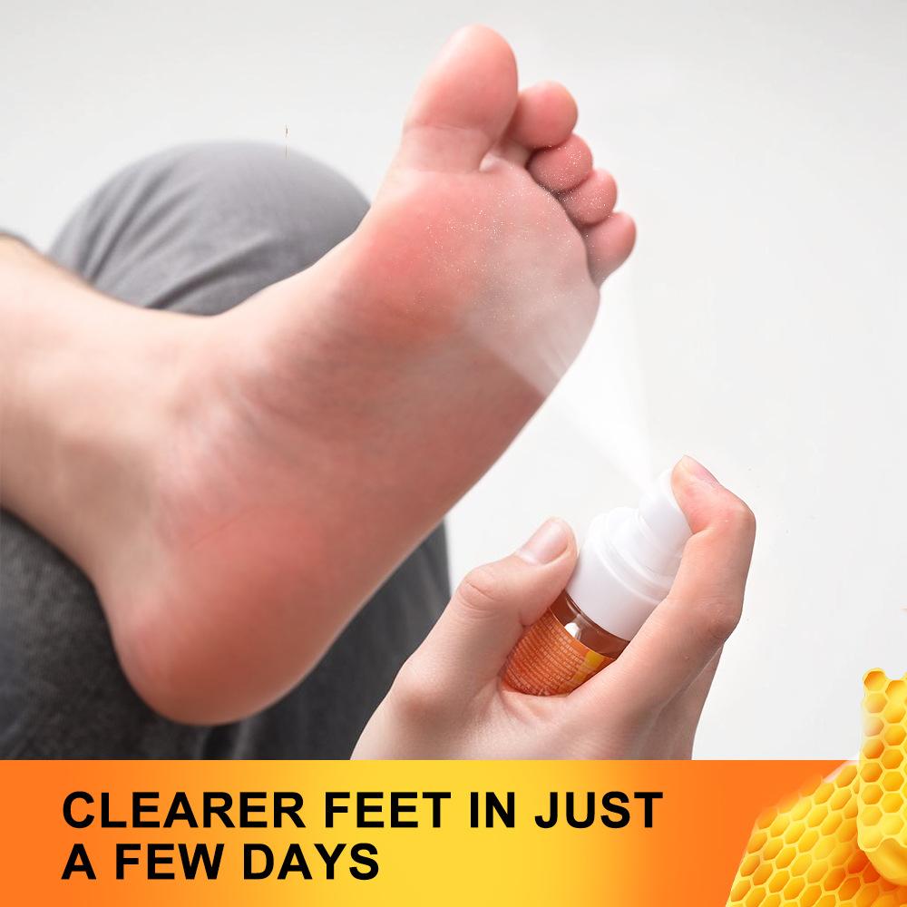 Sumifun 60/120/300ML Bee Foot Care Spray Relieve Beriberi Foot Odor Nail Antibacterial Onychomycosis Repair Spray Summer Essential
