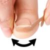 20-100pcs Adhesive Toenail Patch Ingrown Toe Nail Correction Sticker Foot Corrector Pedicure Health Care Tools Toe Treatment Pad