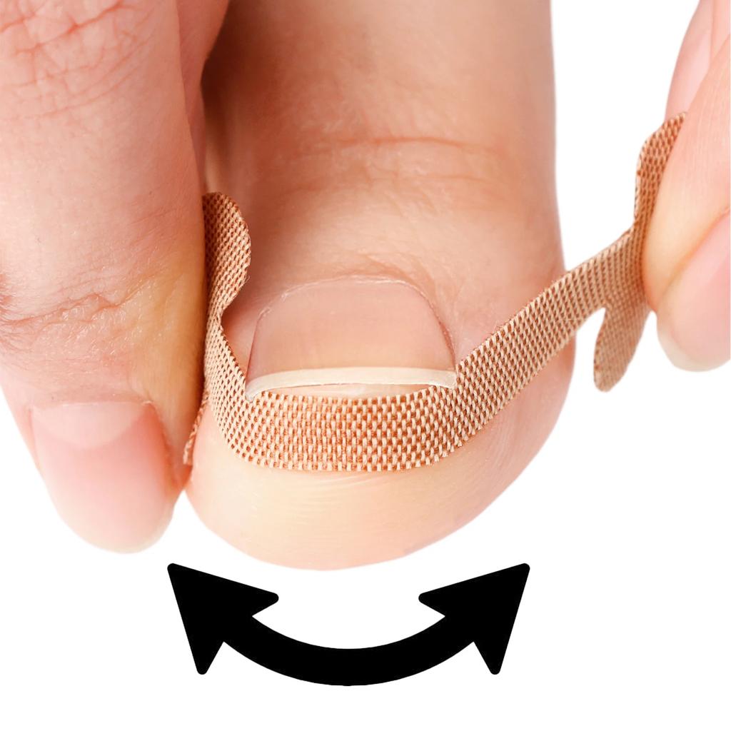 20-100pcs Adhesive Toenail Patch Ingrown Toe Nail Correction Sticker Foot Corrector Pedicure Health Care Tools Toe Treatment Pad