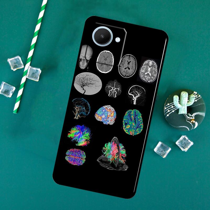 Anatomie Gehirn Für Realme C71 C75 C55 C53 C67 C61 C33 C63 C51 10 11 12 13 14 Pro Plus C65 GT7 15 Pro Hülle