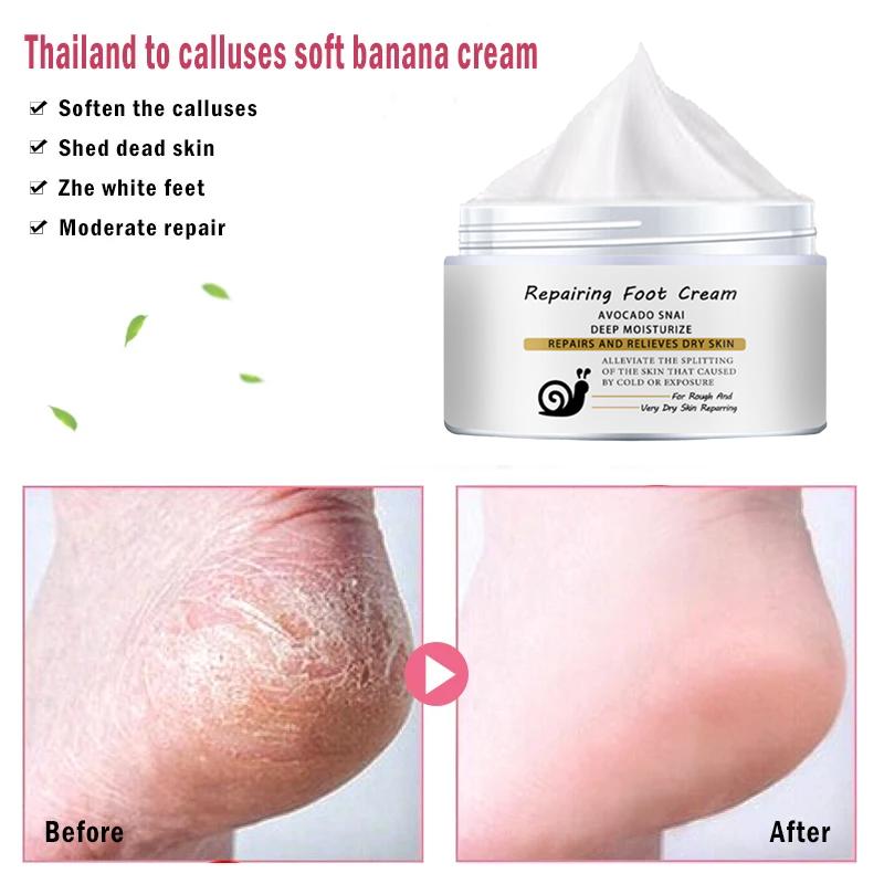 Repair Foot Cream for chapped, broken hands/heels, natural essence cream, gentle and non-irritating