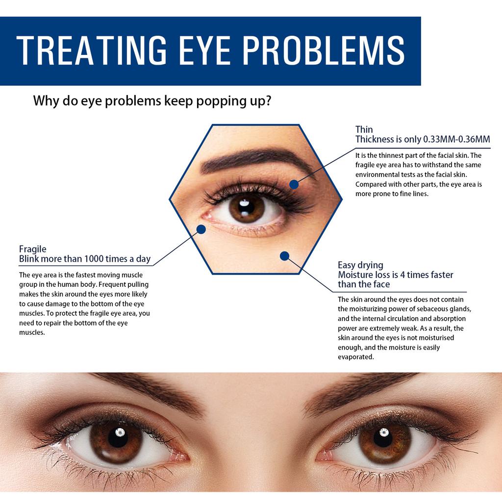 EELHOE Hyaluronic Acid Whitening Eye Cream Anti Dark Circles Eye Bags Wrinkle Removal Skin Serum Brighten Moisturizer Eyes Beauty Health