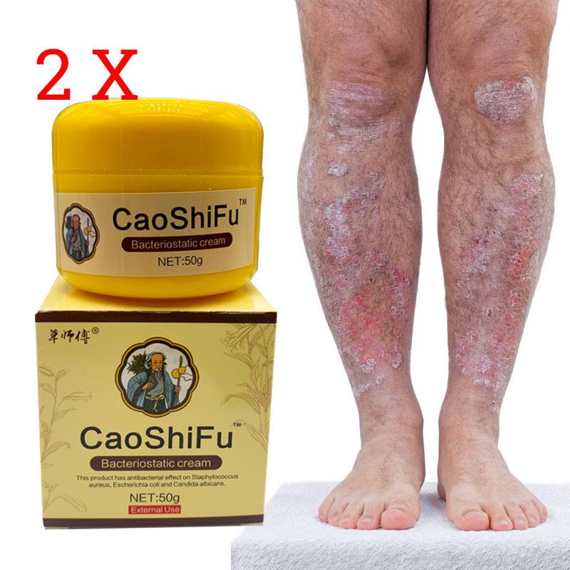 Skin Care Ointment Anti Itch Anti Bacterial, Natural Ointment Relieves Various Skin Problems 50g