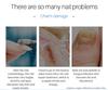 Nail Care Pen – Cuticle & Hangnail Remover, Softens & Strengthens Nails, Fungal Nail Care Treatment less