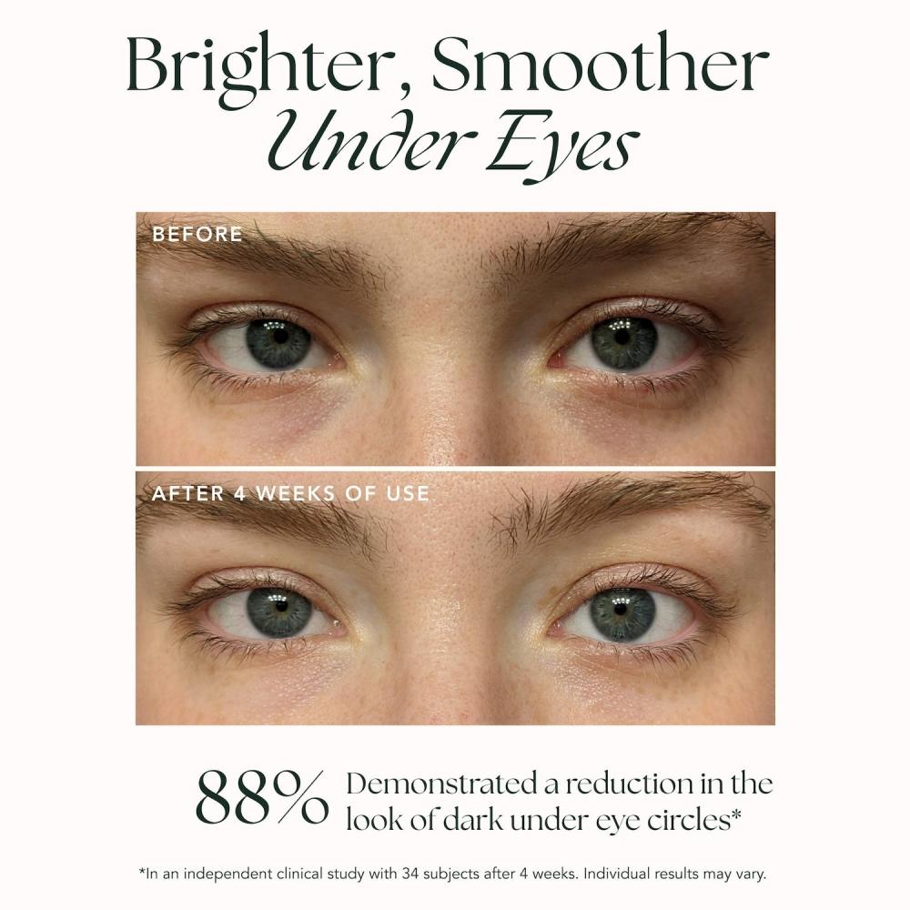 Ranavat Brightening Retinol Eye Creme 0.5 Oz For Fine Lines   Dark Circles