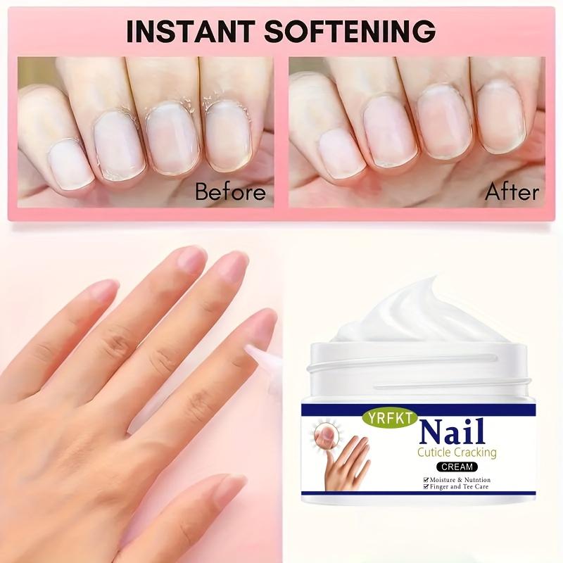 Natural nail care cream, gentle and moisturizing, used for nail care to prevent dryness. Physical exfoliation