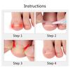 10Pcs Ingrown Toenail Correction Patch – Treatment Adhesive for Paronychia and Nail Alignment