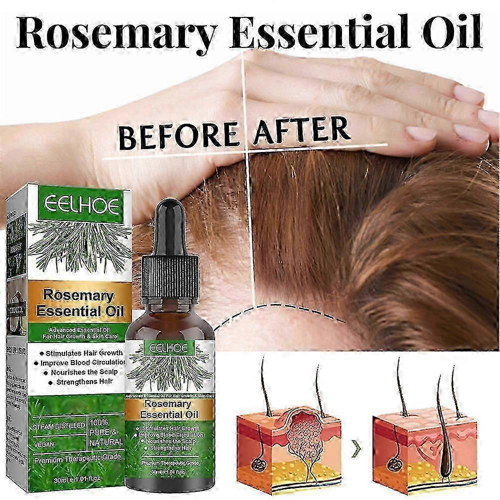 3x EELHOE Hair Oil For Dry Scalp Stimulates Hair Growth Hair Care Essential Oil Refreshing Firming Skin Rosemary Oil