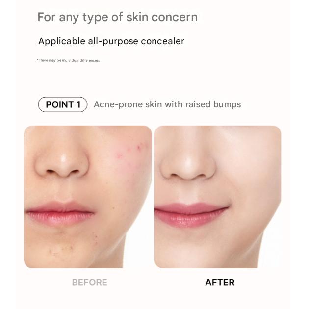 Medicube Red Concealer (Tip Type) 5ml (3 Options)