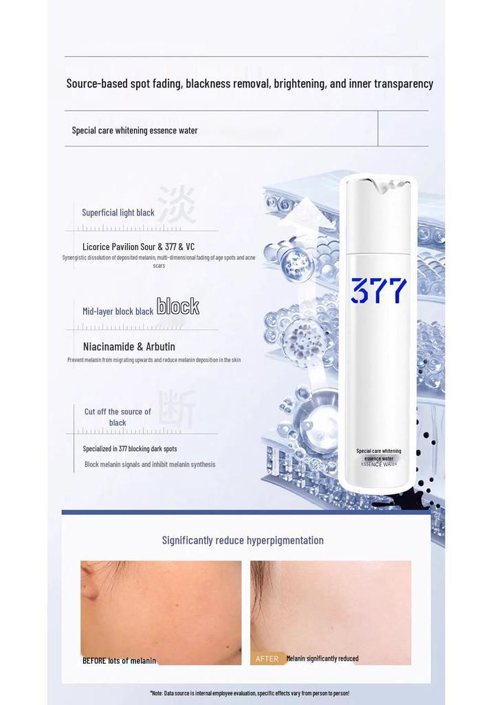 377 Brightening Skincare Set: Face Cream & Toner for Whitening Treatment and Spot Removal