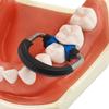 Dental Sectional Matrices Clip Matrix System NITI and Peek Material Ring Matrix Bands Dentistry Instrument Tool