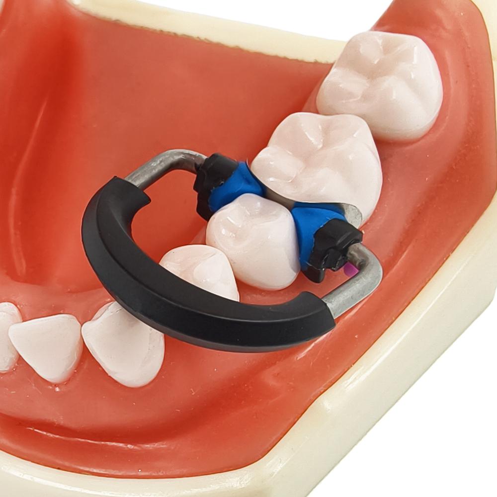 Dental Sectional Matrices Clip Matrix System NITI and Peek Material Ring Matrix Bands Dentistry Instrument Tool