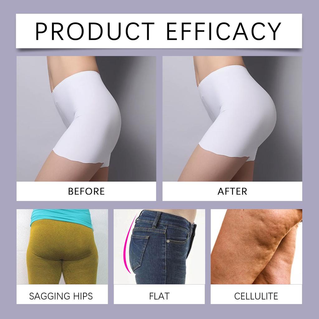 Lifting Tight Cream Buttocks Care Pale Lines Tight Lifting Moisturizing Body Burning