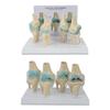 4-Stage Human Knee Evolution Model for Teaching and Display