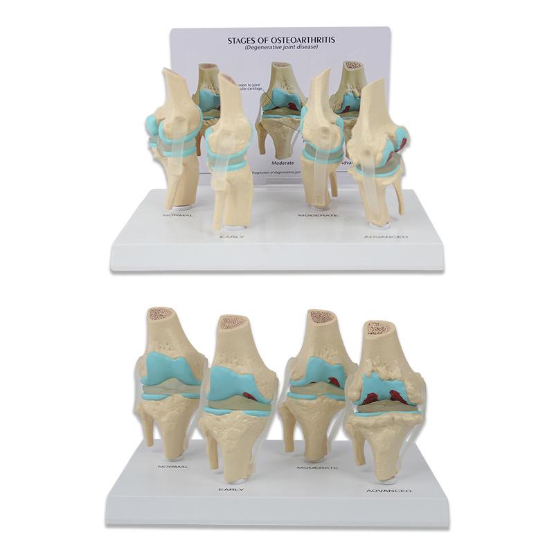 4-Stage Human Knee Evolution Model for Teaching and Display