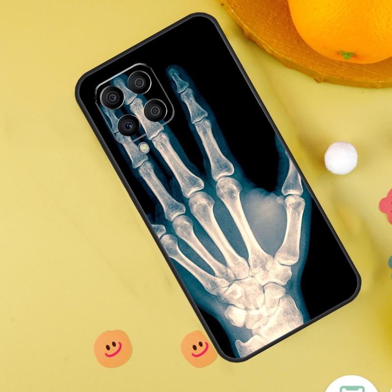 X-Ray Human Anatomy For Samsung Galaxy M54 M34 M14 M12 M32 M52 M53 M33 M13 M20 M21 M51 M15 M55 M31s M30s Case